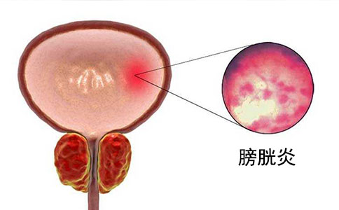 廣州尿動(dòng)力分析儀