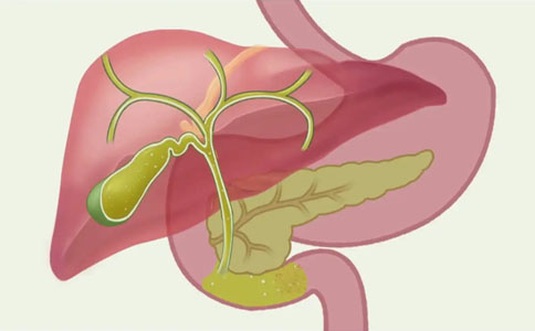 膽結(jié)石治療