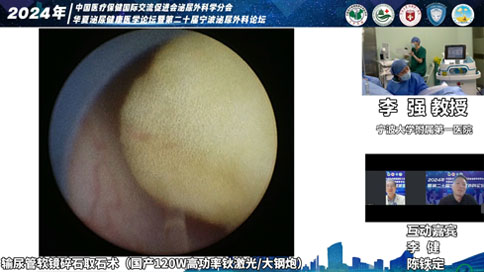 輸尿管軟鏡碎石取石術(shù)（國產(chǎn)120W高功率鈥激光/大鋼炮）