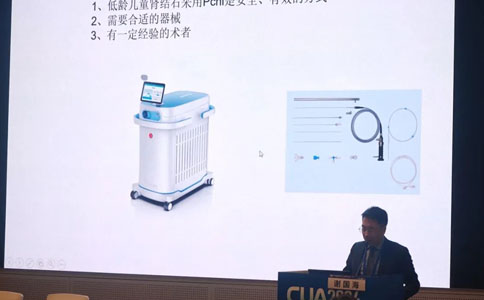 高功率鈥激光在兒童碎石中的獨(dú)特優(yōu)勢(shì)