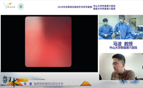 輸尿管軟鏡碎石取石術(shù)