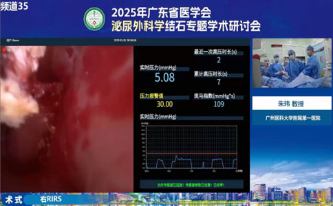 高功率鈥激光設(shè)備