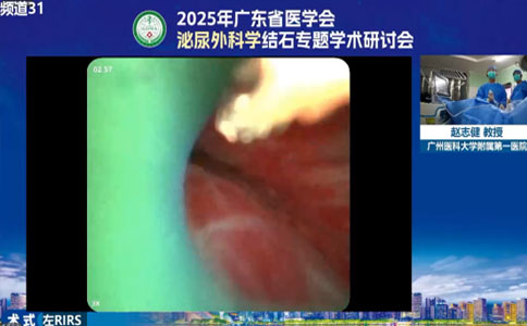 大鋼炮設(shè)備